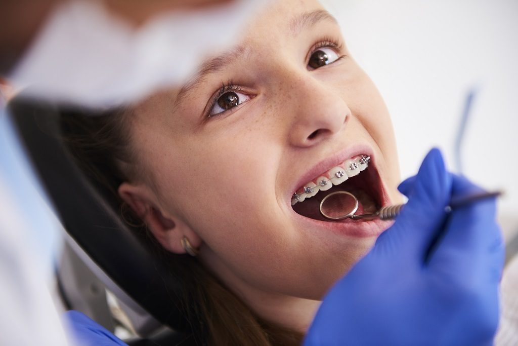¿Cuál es la edad ideal para empezar con una ortodoncia infantil?