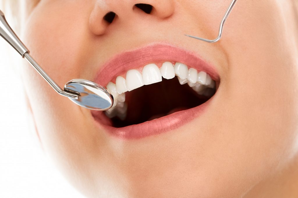 Duración de un implante dental