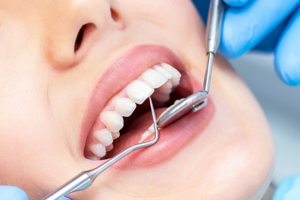 ¿Cada cuánto hay que realizar una limpieza dental?